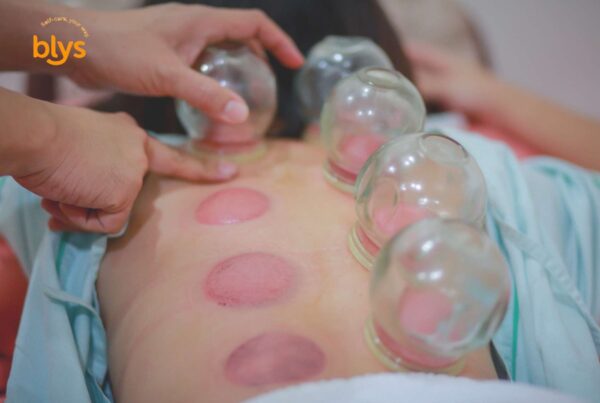 Types of Cupping Therapy