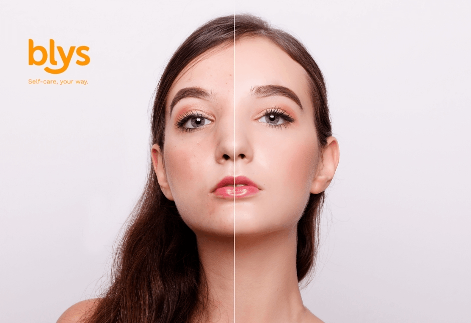 Portfolio photography showing a woman’s face split vertically: blemished skin on one side, smooth radiant skin on the other, conveying transformation. Blys logo on top left side.