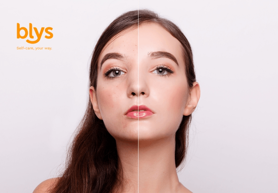 Portfolio photography showing a woman’s face split vertically: blemished skin on one side, smooth radiant skin on the other, conveying transformation. Blys logo on top left side.